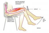 reflex patellar tendon